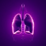 Bệnh bụi phổi silic là gì? Triệu chứng và phòng ngừa đúng cách