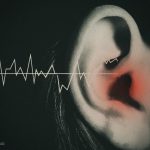 Bị ù tai là bệnh gì? Mẹo chữa ù tai nhanh hiệu quả tại nhà