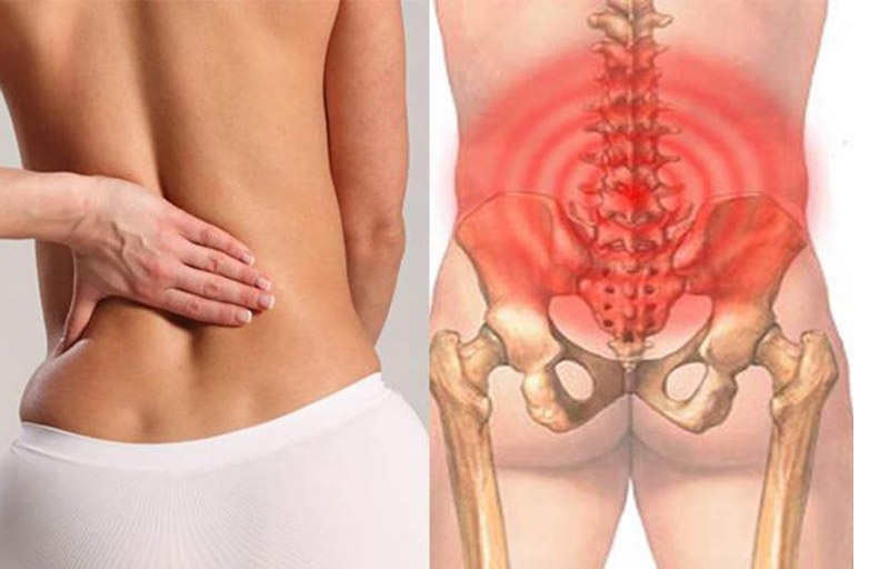 Nguyên nhân gây tê tủy sống gây đau lưng