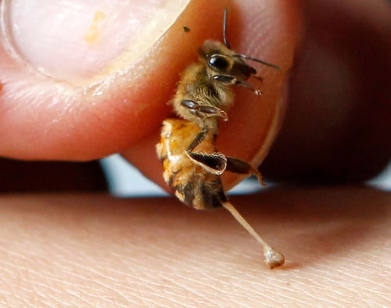 Cách chữa viêm khớp dạng thấp bằng nọc ong