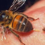 2 cách chữa viêm khớp dạng thấp bằng nọc ong