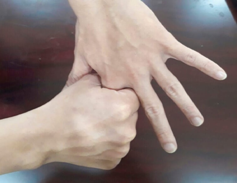 Cách giảm đau khớp ngón tay trỏ