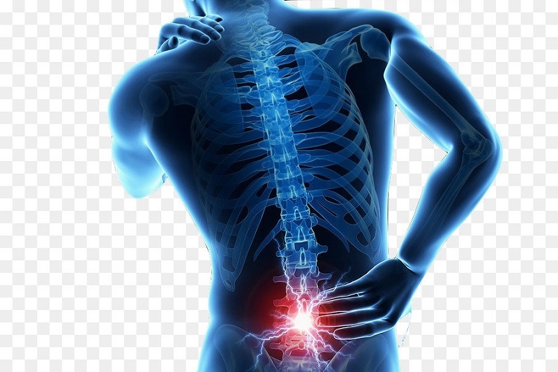 Chẩn đoán đau lưng