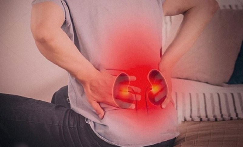 Sỏi thận nguyên nhân gây đau lưng về đêm