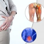Hội chứng thắt lưng hông là gì? Dấu hiệu và điều trị