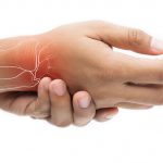 Viêm khớp cổ tay nguyên nhân, chẩn đoán và điều trị