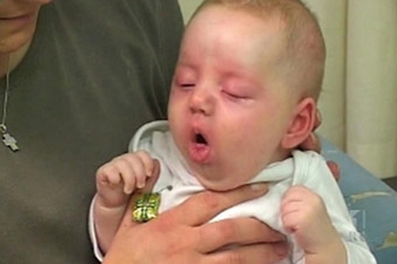 Viêm phổi ở trẻ sơ sinh có nguy hiểm không