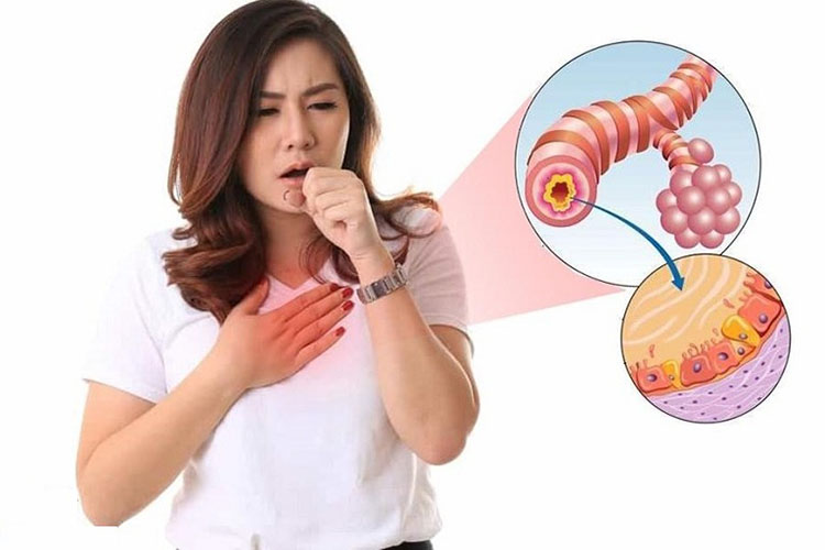 Triệu chứng viêm phế quản phổi
